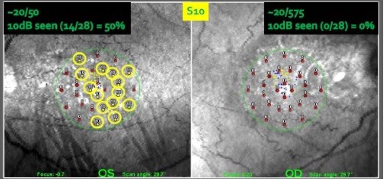 scanned binocular image of eyes with testing points