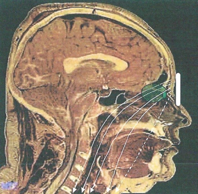 MRI image of human head